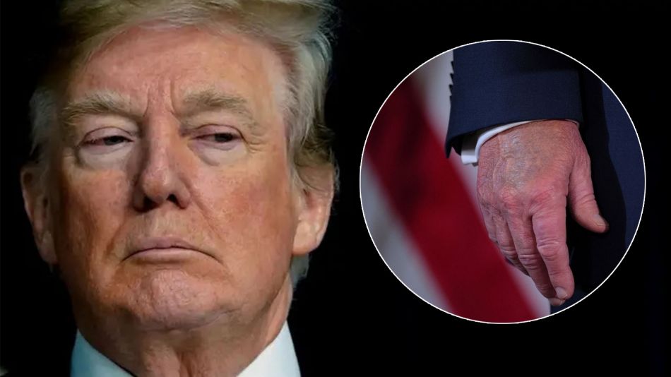 Donald Trump se somete a chequeo médico por hinchazón en las piernas causada por insuficiencia venosa