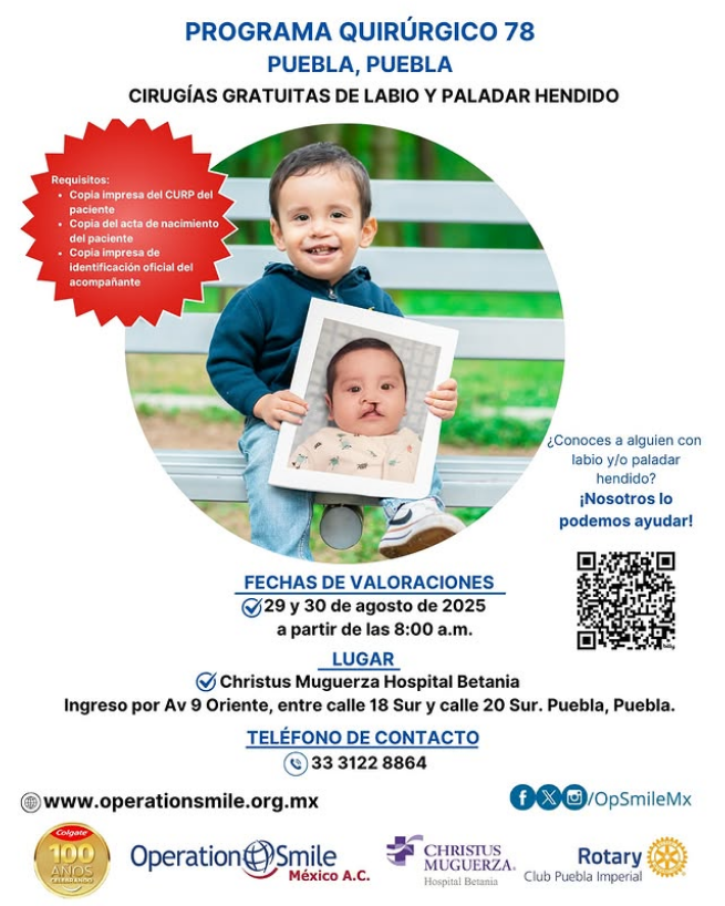 Cirugías gratuitas de labio y paladar hendido en Puebla: Programa Quirúrgico 78 de Operation Smile México