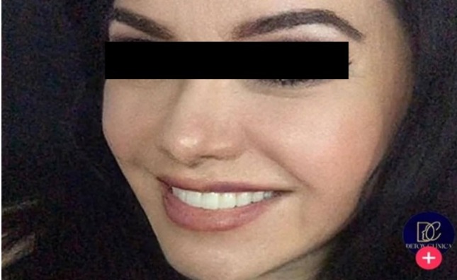 Dueña de clínica estética en Zavaleta donde desapareció Blanca Adriana carece de cédula profesional